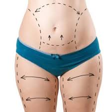 Abdominoplasty in Dubai: A Complete Guide to Tummy Tuck Surgery